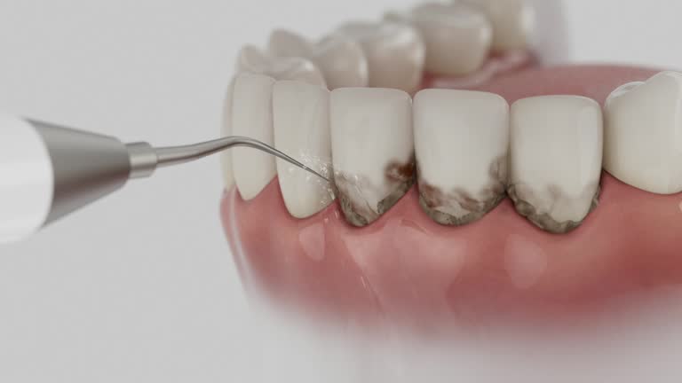Trusted Invisalign Clear Aligners service in Milford, IL - Dentist Open Now